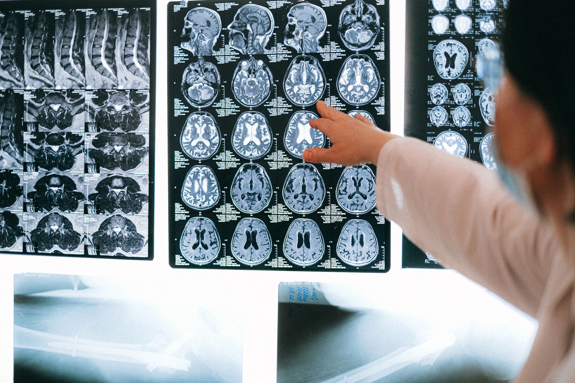 Psilocybin Research in the UK: What’s Actually Happening and What It Means for Mental Health